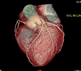 Cardiac 11