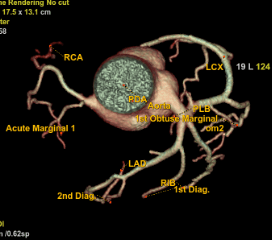Cardiac 12