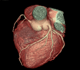 Cardiac 4