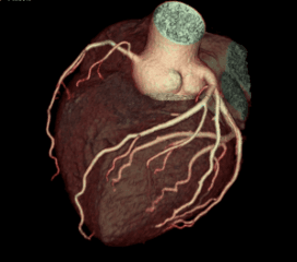 Cardiac 5