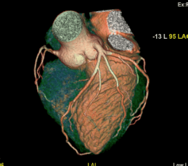 Cardiac 9