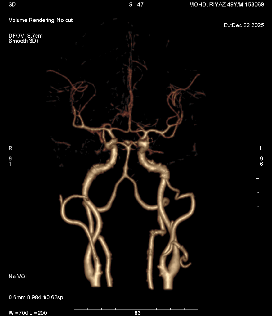 Angiography 3