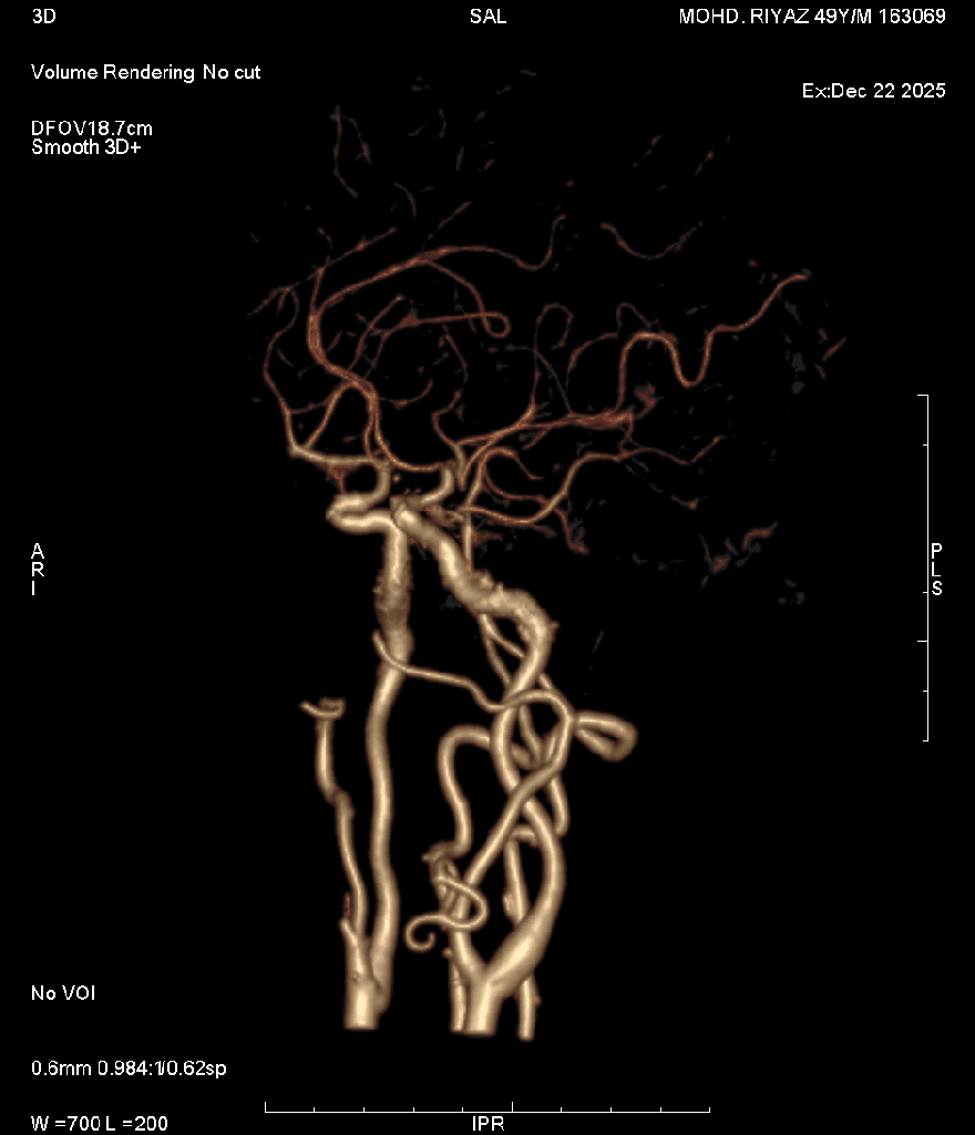 Angiography 4