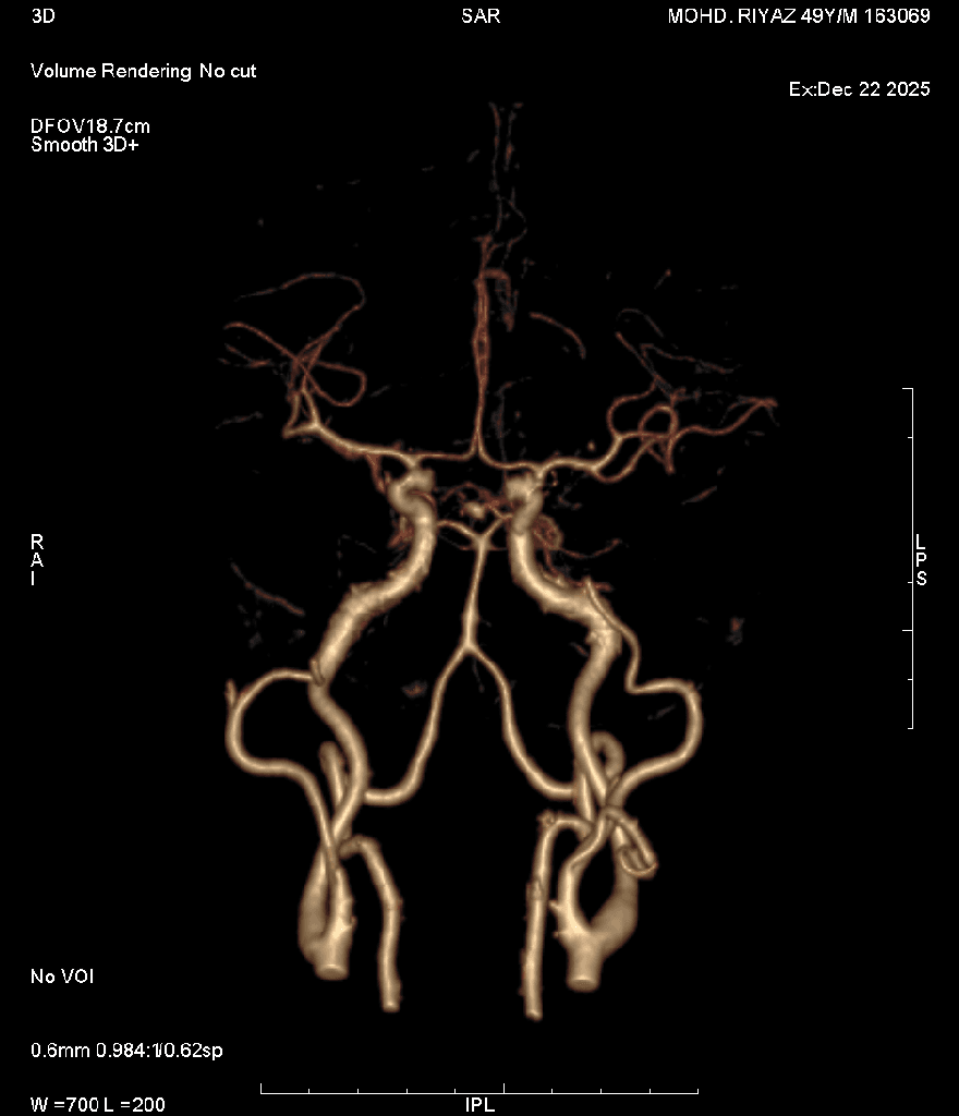 Angiography 8